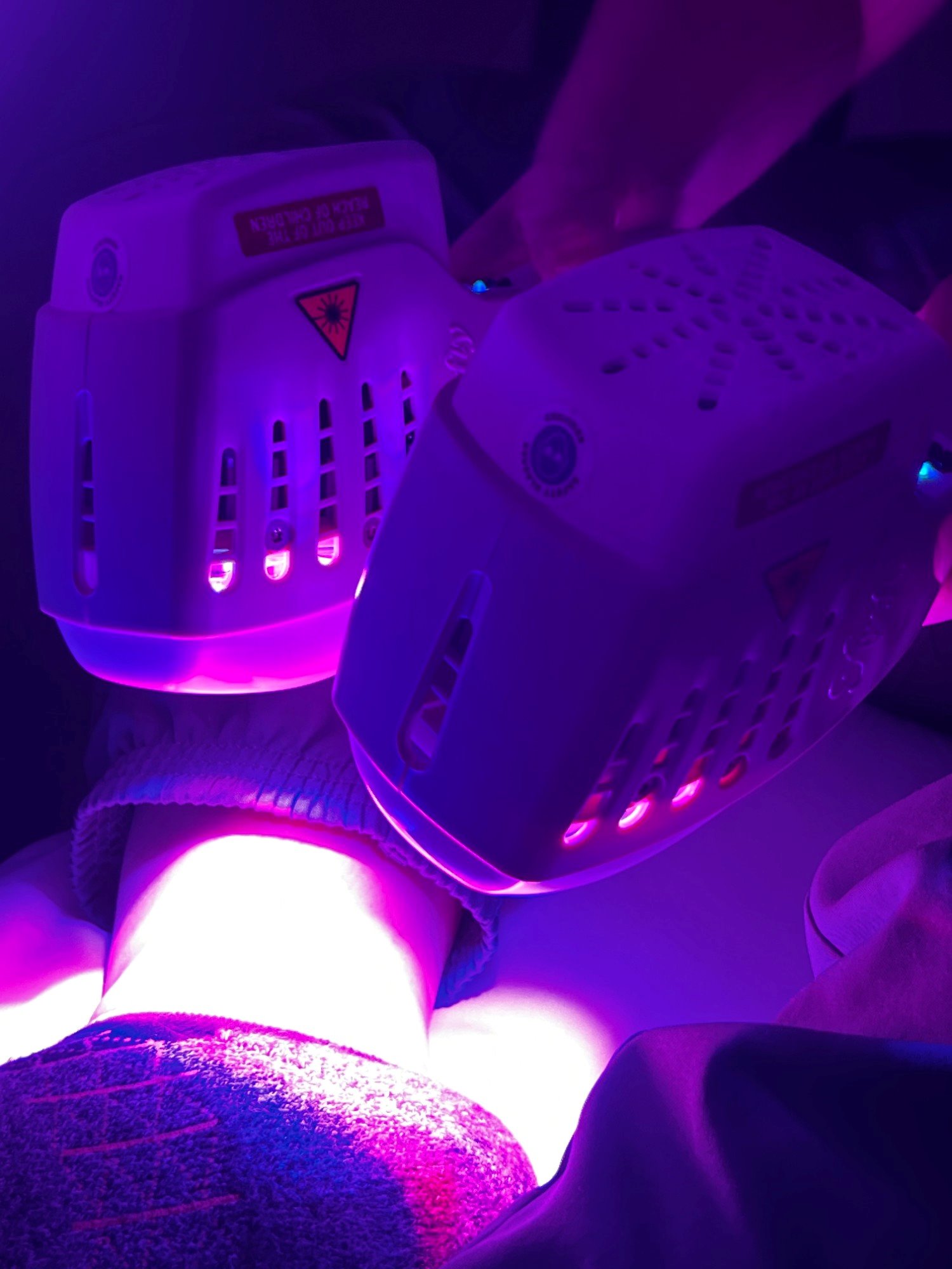 Two Firefly light therapy handpieces glowing over a client's leg